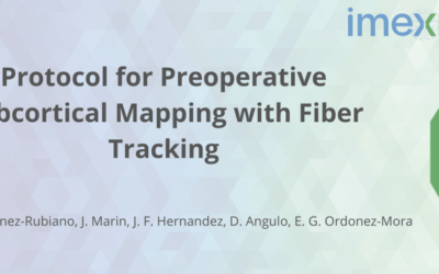 Protocol for Preoperative Subcortical Mapping with Fiber Tracking