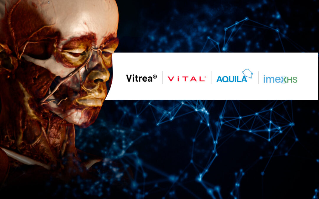 IMEXHS and Vital Images join forces through a global agreement