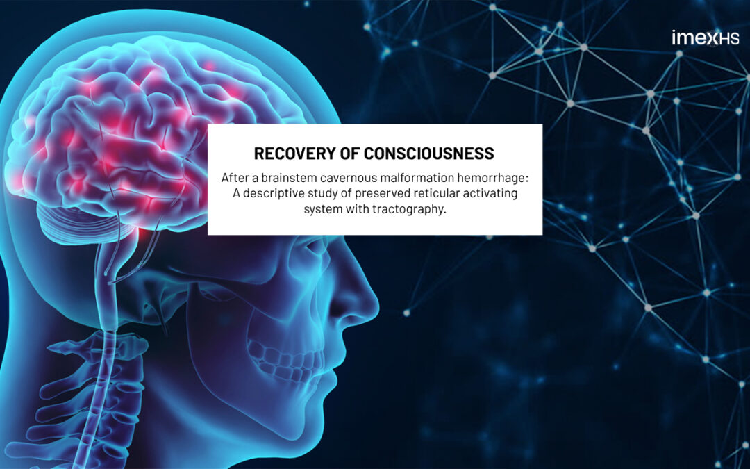 Recovery of consciousness after a brainstem cavernous malformation hemorrhage: A descriptive study of preserved reticular activating system with tractography.