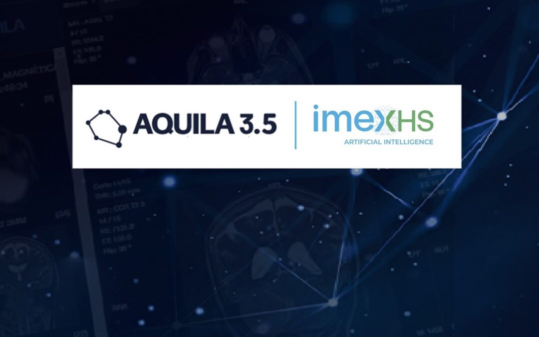 AQUILA goes one step further with its new version 3.5